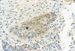 Phospho-ERK1/ERK2 (Thr202, Tyr204, Thr185, Tyr187) Antibody in Immunohistochemistry (Paraffin) (IHC (P))