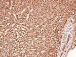 Phospho-ERK1/ERK2 (Thr202, Tyr204, Thr185, Tyr187) Antibody in Immunohistochemistry (Paraffin) (IHC (P))