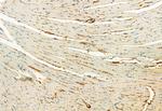 Phospho-FGFR Pan (Tyr653, Tyr654) Antibody in Immunohistochemistry (Paraffin) (IHC (P))