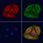 Phospho-GAB2 (Tyr614) Antibody in Immunocytochemistry (ICC/IF)