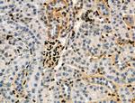 Phospho-RXRA (Ser260) Antibody in Immunohistochemistry (Paraffin) (IHC (P))