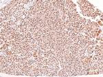 Phospho-alpha Dystroglycan (Tyr892) Antibody in Immunohistochemistry (Paraffin) (IHC (P))