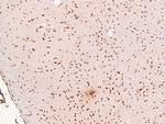 Phospho-alpha Dystroglycan (Tyr892) Antibody in Immunohistochemistry (Paraffin) (IHC (P))