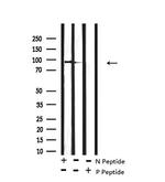 Phospho-alpha Dystroglycan (Tyr892) Antibody in Western Blot (WB)