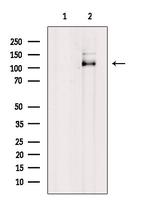 Phospho-Androgen Receptor (Tyr269) Antibody in Western Blot (WB)