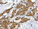 Phospho-Leptin Receptor (Tyr1141) Antibody in Immunohistochemistry (Paraffin) (IHC (P))