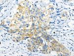 Phospho-Leptin Receptor (Tyr1141) Antibody in Immunohistochemistry (Paraffin) (IHC (P))