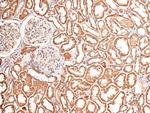 Phospho-FGFR1/FGFR2 (Tyr730, Tyr733) Antibody in Immunohistochemistry (Paraffin) (IHC (P))