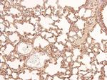 Phospho-FGFR1/FGFR2 (Tyr730, Tyr733) Antibody in Immunohistochemistry (Paraffin) (IHC (P))