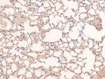 Phospho-IFNAR1 (Ser535) Antibody in Immunohistochemistry (Paraffin) (IHC (P))