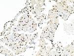 Phospho-Androgen Receptor (Tyr535) Antibody in Immunohistochemistry (Paraffin) (IHC (P))