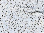 Phospho-Androgen Receptor (Tyr535) Antibody in Immunohistochemistry (Paraffin) (IHC (P))