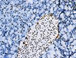 Phospho-Androgen Receptor (Tyr535) Antibody in Immunohistochemistry (Paraffin) (IHC (P))