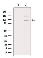 Phospho-Androgen Receptor (Tyr535) Antibody in Western Blot (WB)