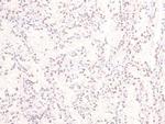 Phospho-Ataxin 3 (Ser256) Antibody in Immunohistochemistry (Paraffin) (IHC (P))