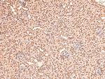 Phospho-BAG3 (Tyr457) Antibody in Immunohistochemistry (Paraffin) (IHC (P))