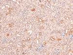 Phospho-BIK (Ser35) Antibody in Immunohistochemistry (Paraffin) (IHC (P))