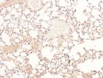 Phospho-BIK (Ser35) Antibody in Immunohistochemistry (Paraffin) (IHC (P))