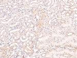 Phospho-DRP1 (Tyr504) Antibody in Immunohistochemistry (Paraffin) (IHC (P))