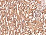 Phospho-CtBP1/CtBP2 (Ser158, Ser164) Antibody in Immunohistochemistry (Paraffin) (IHC (P))