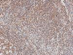 Phospho-CtBP1/CtBP2 (Ser158, Ser164) Antibody in Immunohistochemistry (Paraffin) (IHC (P))