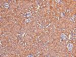 Phospho-CtBP1/CtBP2 (Ser158, Ser164) Antibody in Immunohistochemistry (Paraffin) (IHC (P))