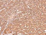 Phospho-CtBP1/CtBP2 (Ser158, Ser164) Antibody in Immunohistochemistry (Paraffin) (IHC (P))