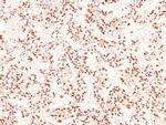 Phospho-CUX1 (Ser1237) Antibody in Immunohistochemistry (Paraffin) (IHC (P))