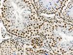 Phospho-NFATC1 (Ser172) Antibody in Immunohistochemistry (Paraffin) (IHC (P))