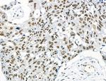 Phospho-NFATC1 (Ser172) Antibody in Immunohistochemistry (Paraffin) (IHC (P))