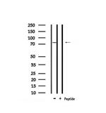 Phospho-PAK6 (Ser165) Antibody in Western Blot (WB)