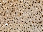 Phospho-RAD17 (Ser646) Antibody in Immunohistochemistry (Paraffin) (IHC (P))