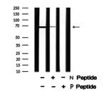 Phospho-SHC3 (Tyr424) Antibody in Western Blot (WB)