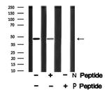 Phospho-SPHK1 (Ser225) Antibody in Western Blot (WB)