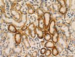 Phospho-SREBP2 (Ser455) Antibody in Immunohistochemistry (Paraffin) (IHC (P))