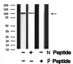 Phospho-TLR3 (Tyr759) Antibody in Western Blot (WB)