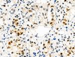 Phospho-TPPP (Ser18) Antibody in Immunohistochemistry (Paraffin) (IHC (P))