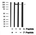 Phospho-LRP6 (Thr1479) Antibody in Western Blot (WB)