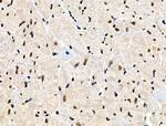 Phospho-PFKFB2 (Ser466) Antibody in Immunohistochemistry (Paraffin) (IHC (P))