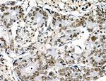 Phospho-POLR2A (Ser1616) Antibody in Immunohistochemistry (Paraffin) (IHC (P))