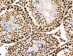 Phospho-POLR2A (Ser1616) Antibody in Immunohistochemistry (Paraffin) (IHC (P))