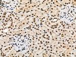 Phospho-POLR2A (Ser1616) Antibody in Immunohistochemistry (Paraffin) (IHC (P))