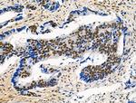 Phospho-POLR2A (Ser1616) Antibody in Immunohistochemistry (Paraffin) (IHC (P))