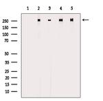 Phospho-POLR2A (Ser1616) Antibody in Western Blot (WB)