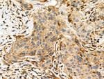 Phospho-TSC2 (Ser1254) Antibody in Immunohistochemistry (Paraffin) (IHC (P))