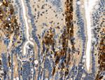 Phospho-TSC2 (Ser1254) Antibody in Immunohistochemistry (Paraffin) (IHC (P))