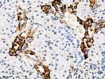 Phospho-TSC2 (Ser1254) Antibody in Immunohistochemistry (Paraffin) (IHC (P))