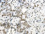 Phospho-ABI1 (Tyr213) Antibody in Immunohistochemistry (Paraffin) (IHC (P))