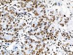 Phospho-ABI1 (Tyr213) Antibody in Immunohistochemistry (Paraffin) (IHC (P))