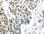 Phospho-ABI1 (Tyr213) Antibody in Immunohistochemistry (Paraffin) (IHC (P))